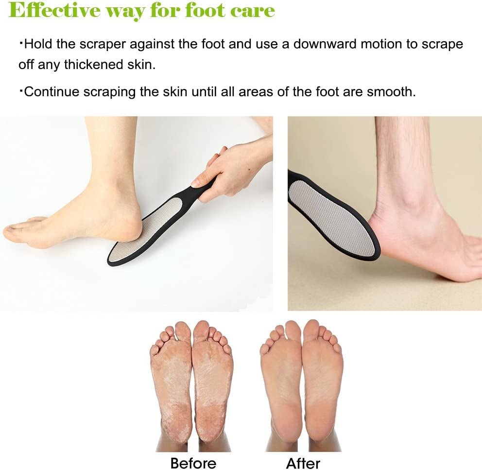 Premium Foot File, Double Side Pedicure Rasp, Dead Hard Cracked Skin Calluses Remover, Portable Foot Care Tool, Heavy Duty Stainless Steel (Soft Silicone Handle)